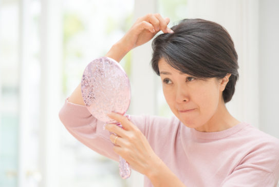 円形脱毛症の全頭型とはどのように付き合っていけばよいのか?