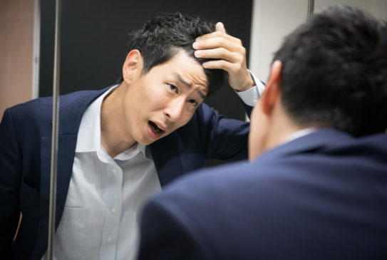 加古川市周辺はAGA対策の選択肢が多くて悩む！いいねヘアケアラボなら包括的なアドバイスが可能！