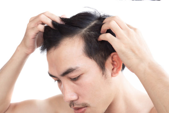 AGAは病院の何科に相談したらいいの?