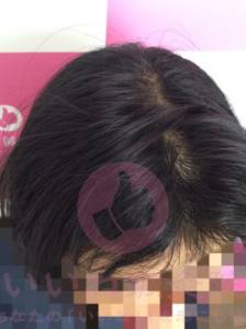 アフター