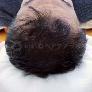 アフター