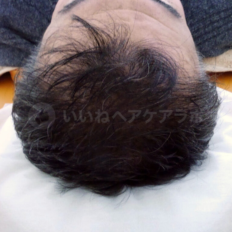 アフター