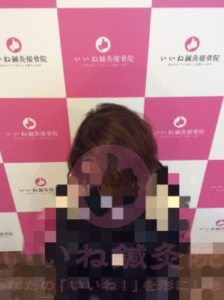 アフター