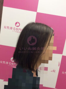 アフター