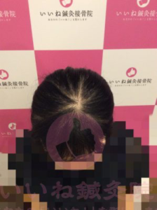 ビフォー