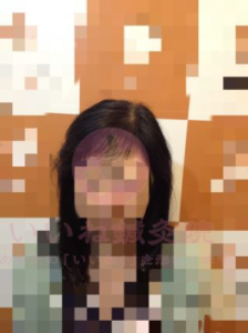 ビフォー
