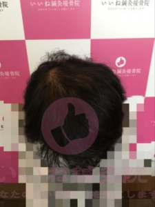 アフター