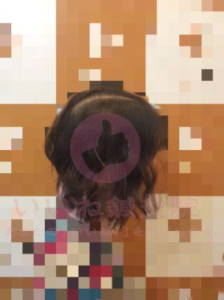 ビフォー