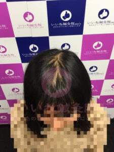ビフォー