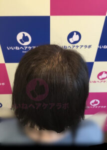アフター