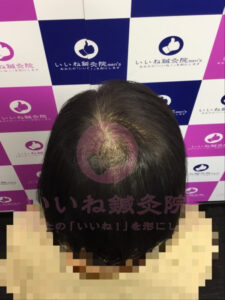 ビフォー