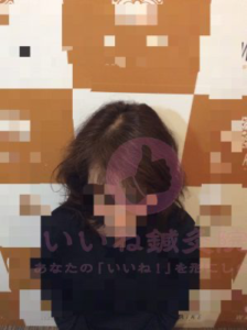 アフター