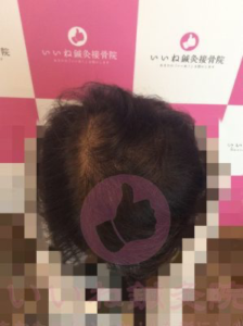 ビフォー