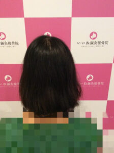 ビフォー