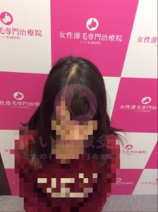 ビフォー