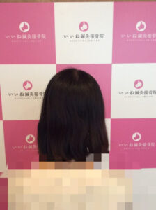 アフター