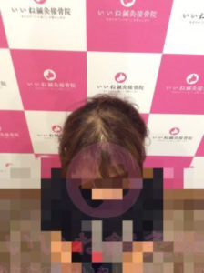 ビフォー
