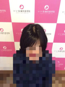ビフォー
