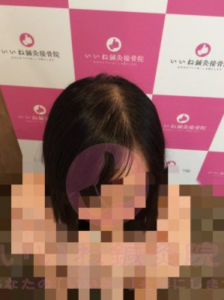 アフター