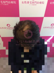 アフター
