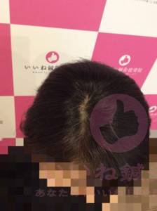 ビフォー