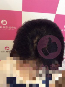 アフター