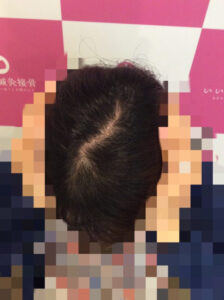 ビフォー