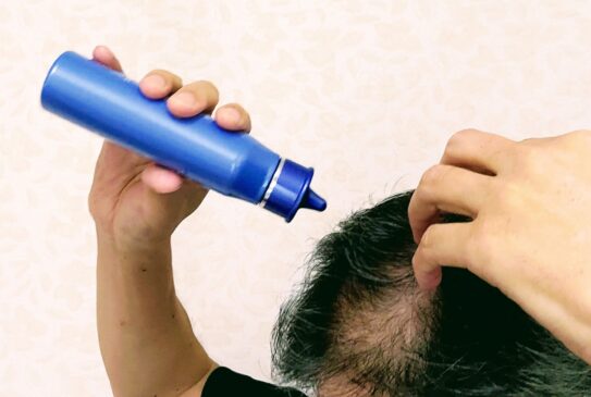 もう悩まない！自宅でできる薄毛対策まとめ【ヘアケア・栄養・運動・育毛法を徹底解説】
