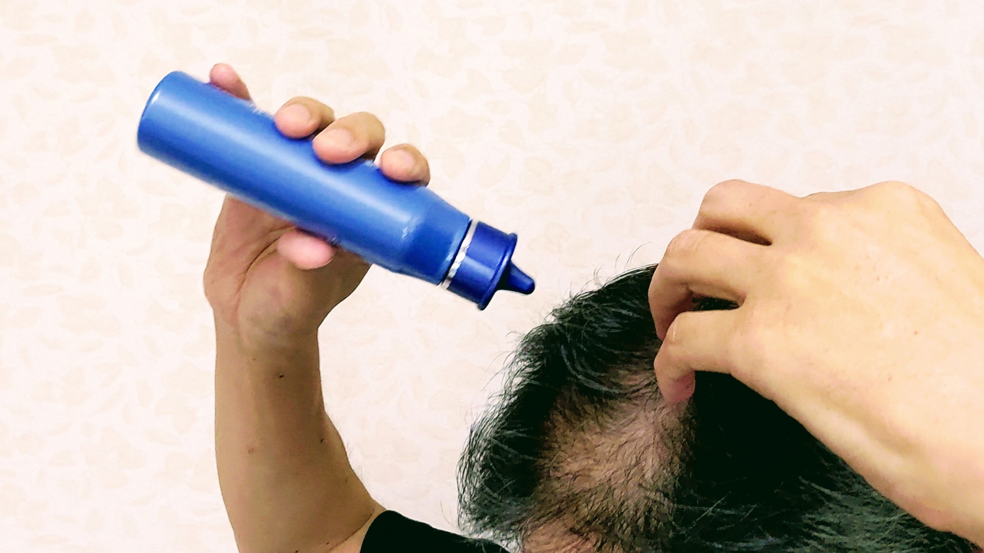 もう悩まない！自宅でできる薄毛対策まとめ【ヘアケア・栄養・運動・育毛法を徹底解説】