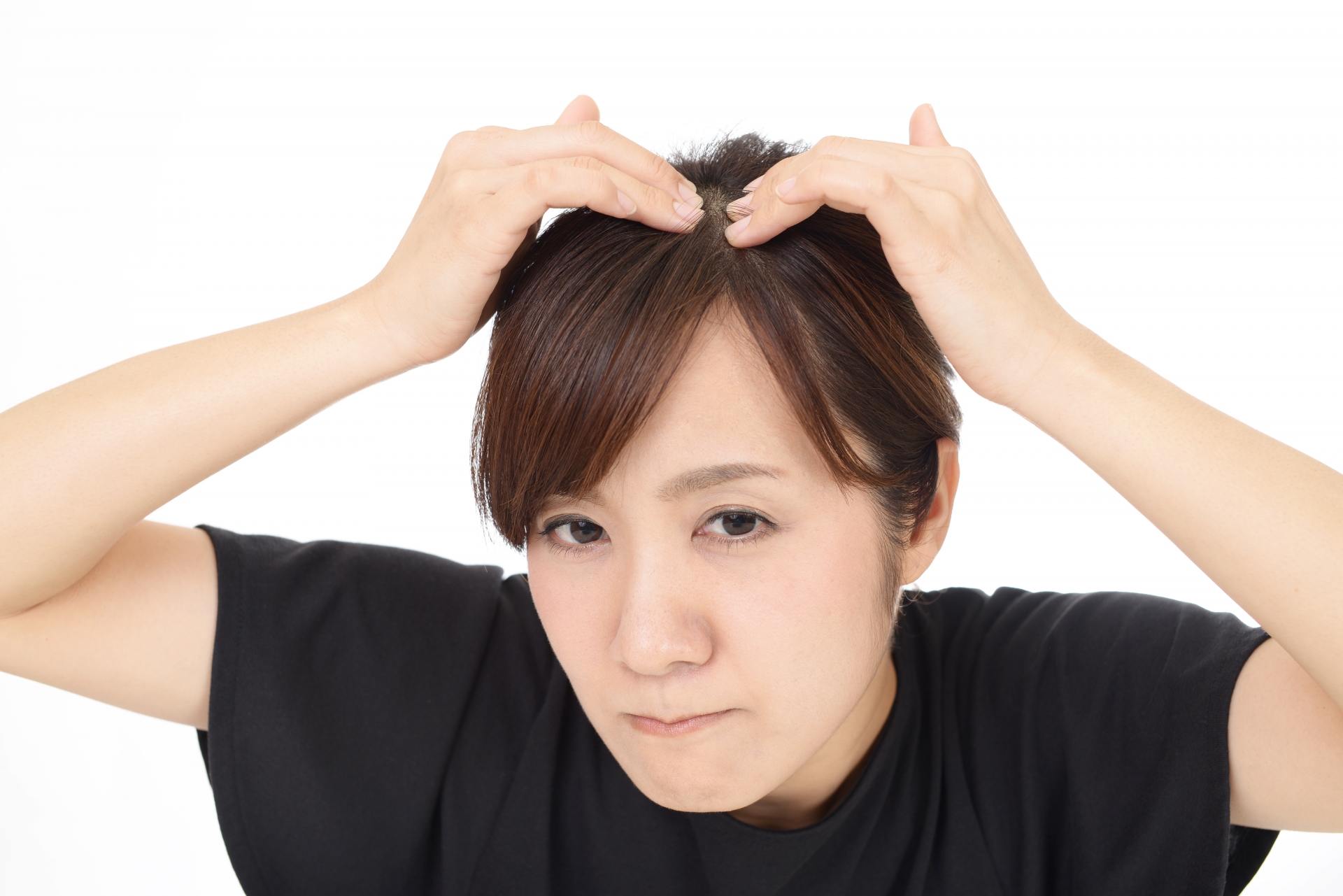 AGA治療を成功させるためのセルフケア戦略