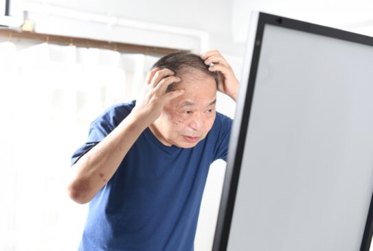 見た目年齢を守るための「はげ」対策ガイド：原因から予防法、心のケアまで