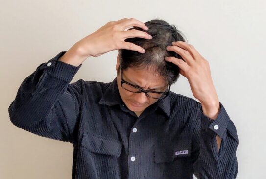 AGAを進行させないための生活習慣と治療法：髪の健康を守る10の対策