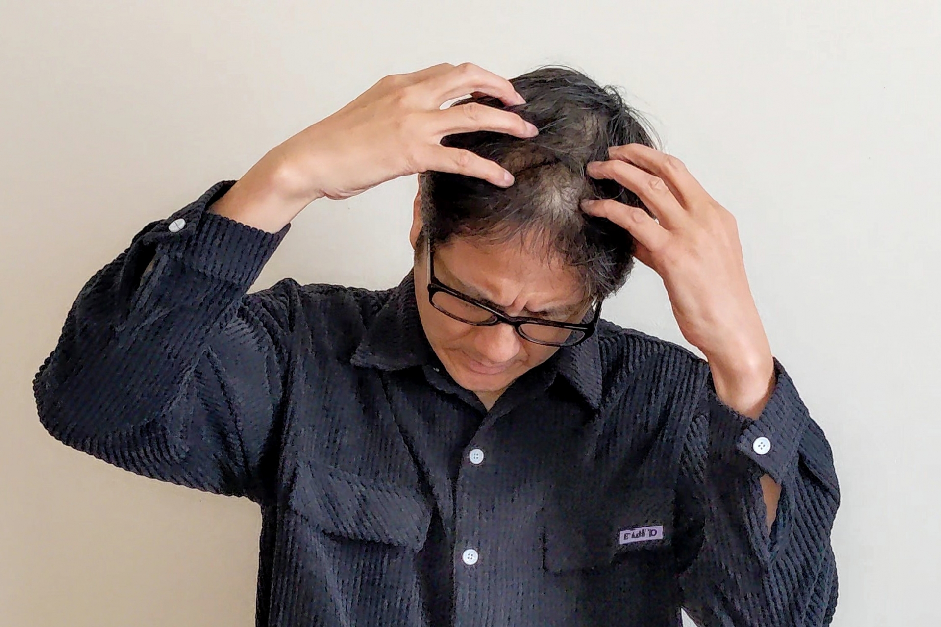 AGA治療を始める前に知るべき毛髪の基礎知識と進行の仕組み