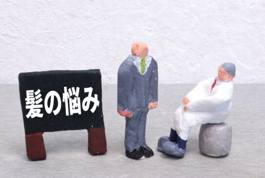 M字はげを最も自然に治す!自毛植毛の全知識と費用