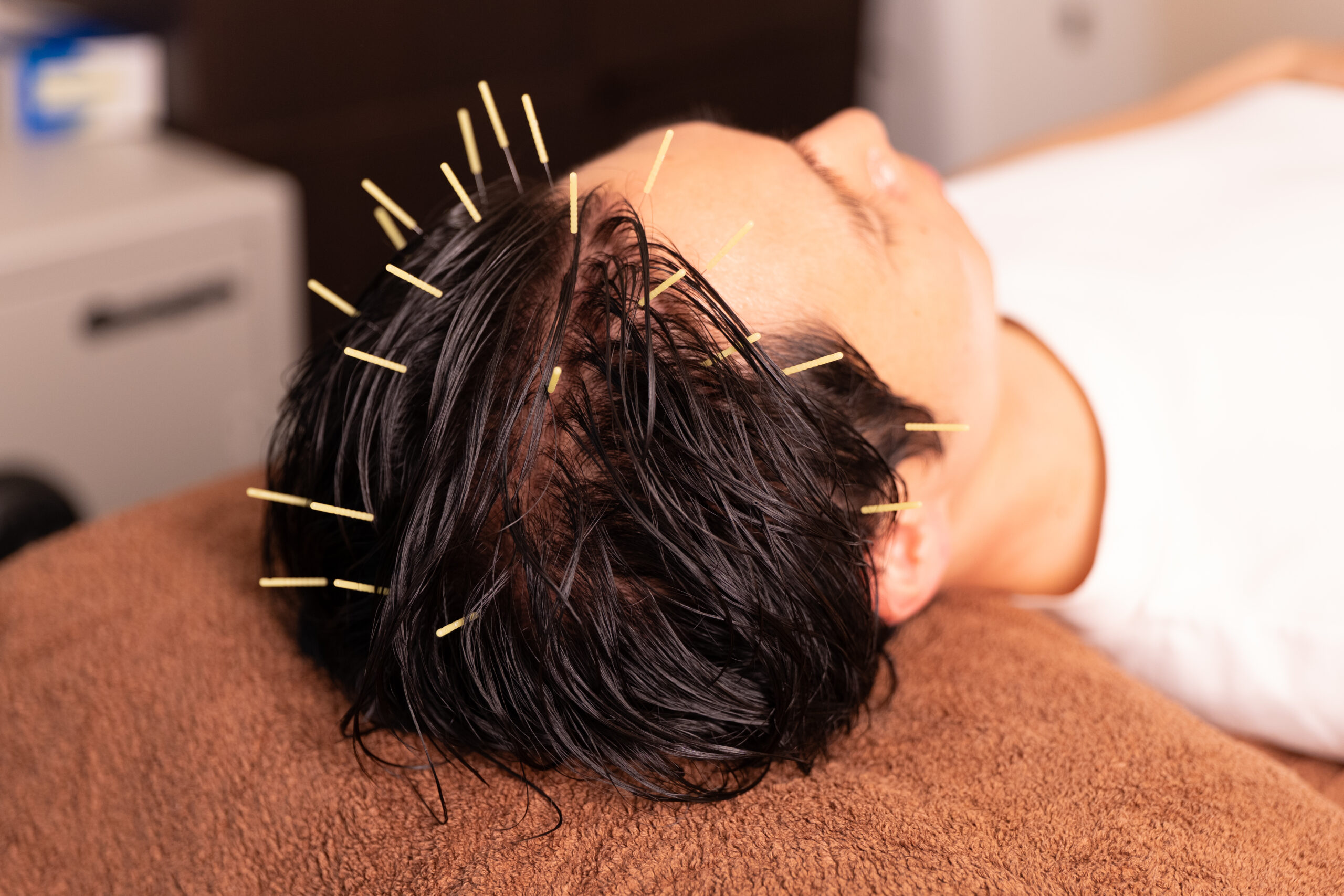 東京のITエンジニア必見！薬なしで取り組む眼精疲労と抜け毛対策