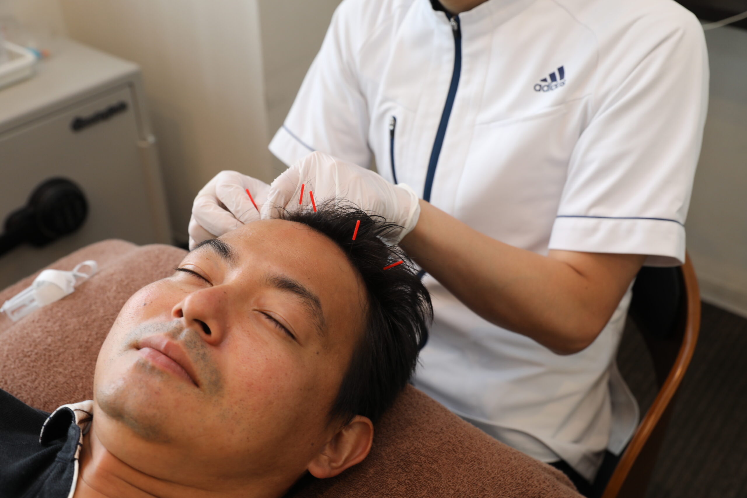 薄毛の原因となる「首こり・肩こり」を鍼で解消