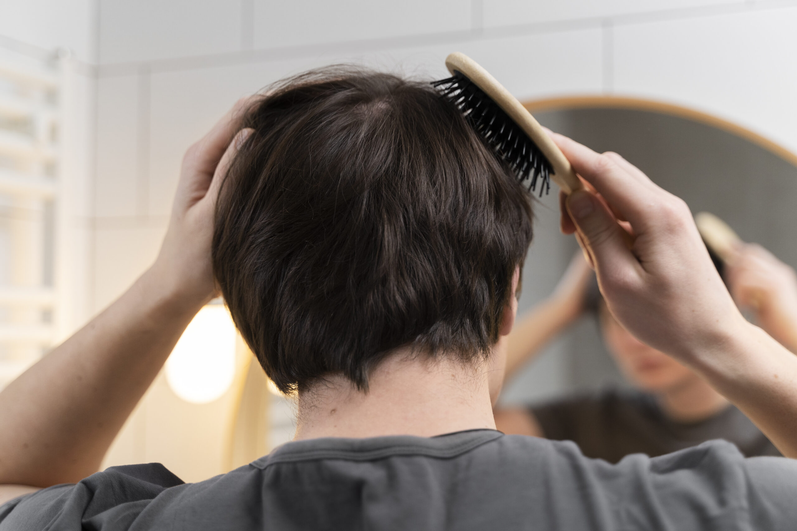 円形脱毛症に対する鍼灸治療のアプローチ