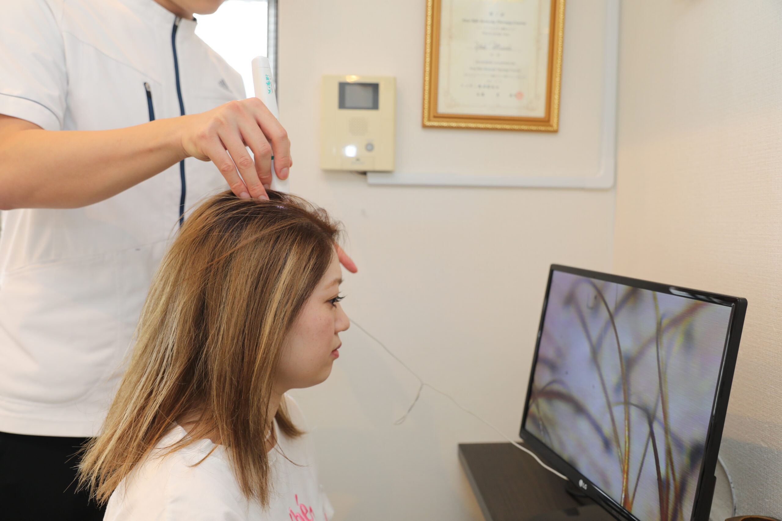 東京の最新ヘアケア!頭皮への鍼がもたらす血流改善と発毛効果|根本から髪を育む