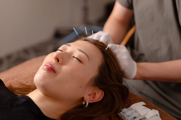 港区の女性に贈る薄毛と鍼で叶える美髪再生